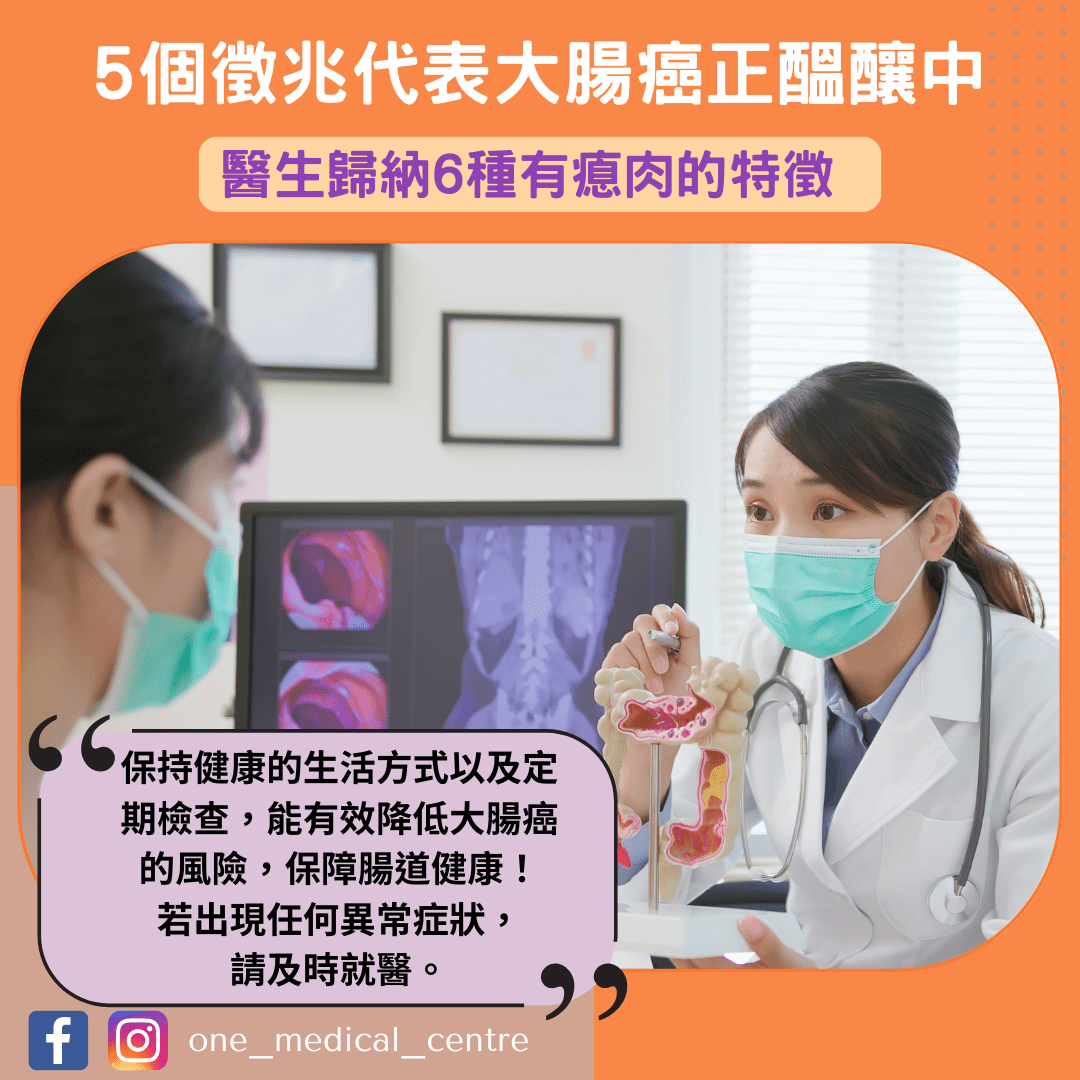 【5個徵兆代表大腸癌正醞釀中　醫生歸納6種有瘜肉的特徵】